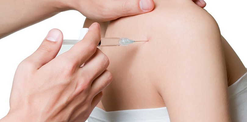 Trigger Point Injections