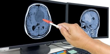 treatments for brain tumors